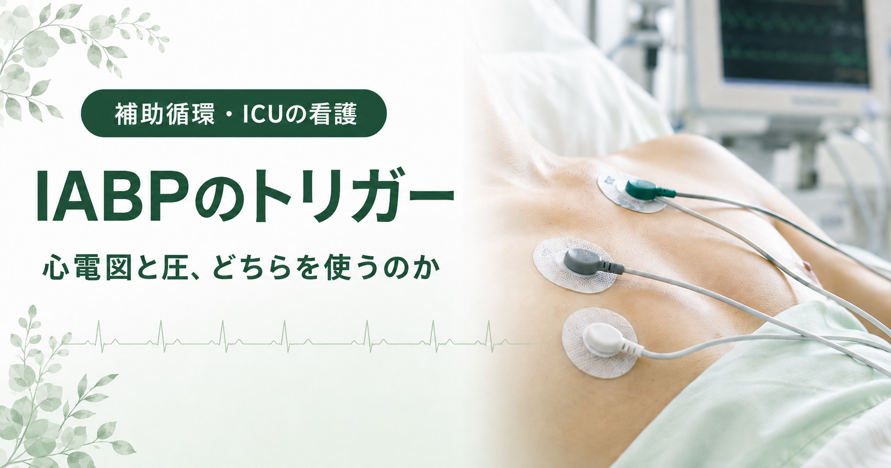 記事「IABPのトリガー|心電図と圧、どちらを使うのか」のアイキャッチ画像。胸に貼られた心電図の電極とリード線が写り、背景にICUのモニターが見える。