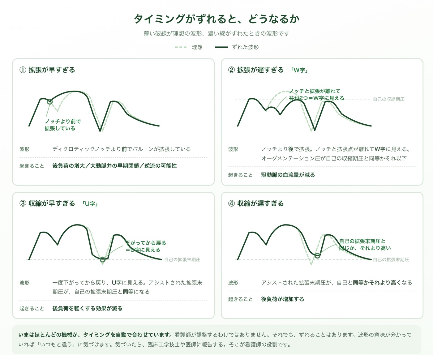 IABPのタイミングがずれたときの波形を4つ並べた図。①拡張が早すぎるとノッチより前で立ち上がる。②拡張が遅すぎると谷が2つできてW字に見える。③収縮が早すぎると一度下がってから戻りU字に見える。④収縮が遅すぎると拡張末期圧が自己と同等かそれより高くなる。薄い破線が理想の波形。