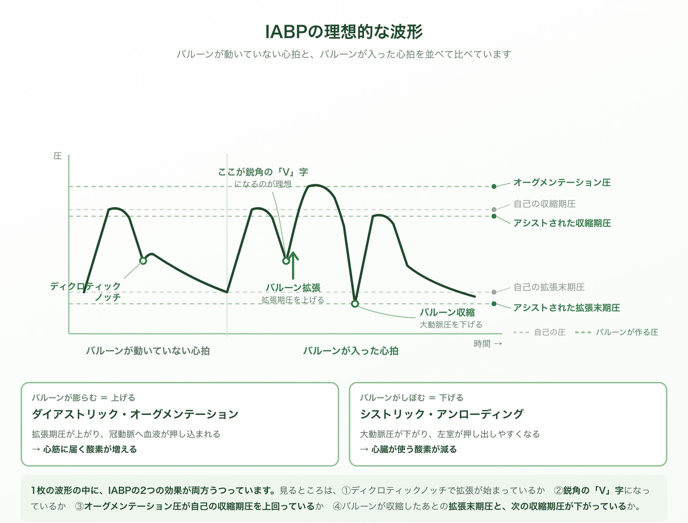 IABPの理想的な動脈圧波形の図。バルーンが動いていない心拍と、バルーンが入った心拍を並べて比較している。ディクロティックノッチで拡張が始まり、鋭角のV字を描いてオーグメンテーション圧が自己の収縮期圧を上回る。バルーン収縮により、アシストされた拡張末期圧と収縮期圧はどちらも自己より低くなる。グレーの破線が自己の圧、緑の破線がバルーンが作る圧。