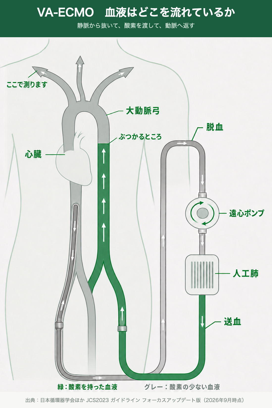 VA-ECMOで血液がどこを流れているかを示した図。体の中に大動脈と心臓、体の外に遠心ポンプと人工肺を描いている。大腿静脈から脱血した酸素の少ない血液（グレー）が遠心ポンプで回され、人工肺で酸素を渡されて緑になり、大腿動脈へ送血されて下行大動脈を足のほうから上へのぼる。いっぽう心臓が押し出した酸素の少ない血液は上行大動脈から大動脈弓の3本の枝へ流れる。両者がぶつかるところが下行大動脈の途中にできる。大動脈弓から出る枝のうち右上肢へ向かう枝に「ここで測ります」と示されている。