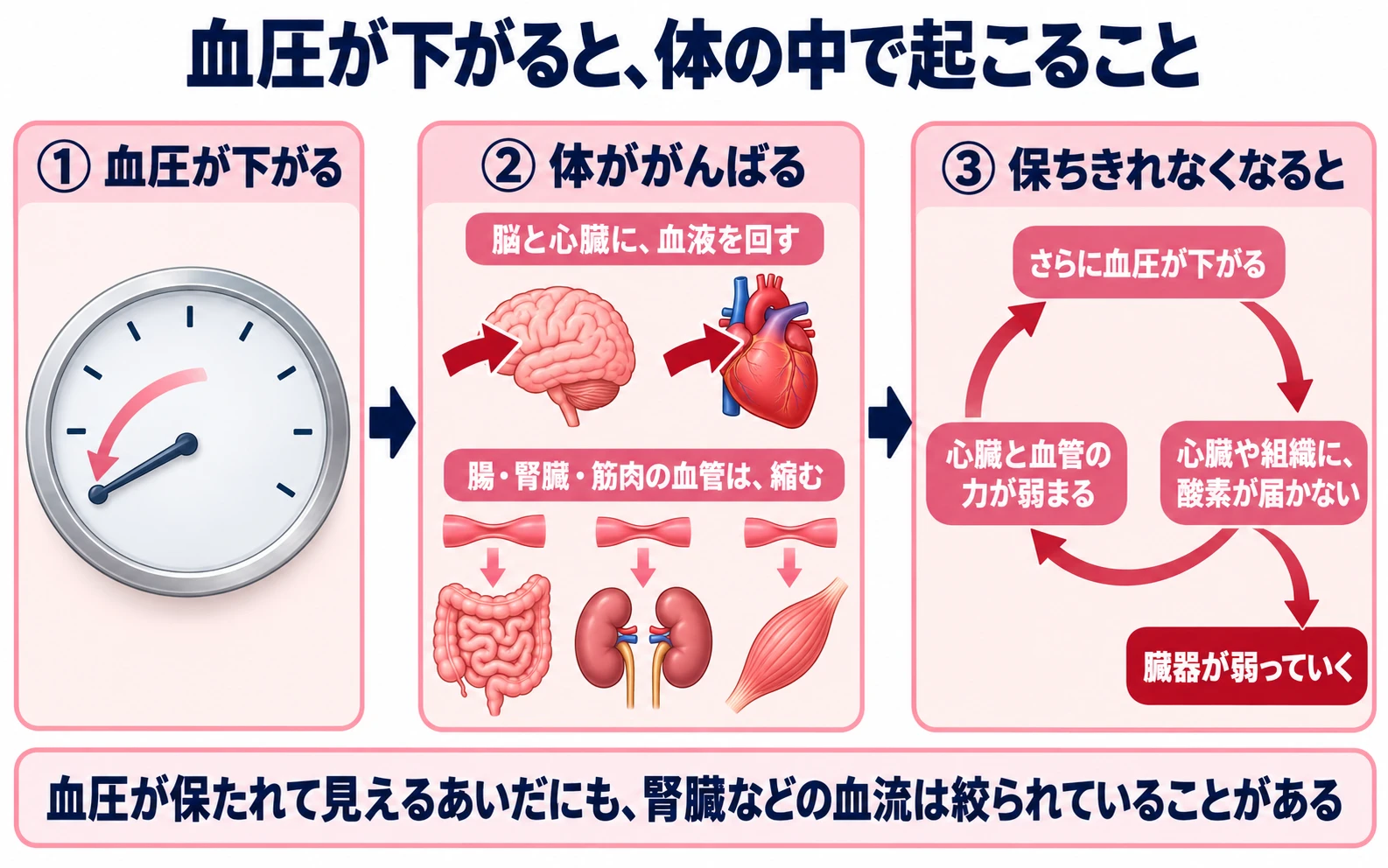 血圧が下がると体の中で起こることを、左から右へ3段階で示した図。①血圧が下がる（針が下がる圧力計）。②体ががんばる：脳と心臓には太い矢印で血液を回し、腸・腎臓・筋肉の血管は縮んで細い矢印になる。③保ちきれなくなると：「さらに血圧が下がる」「心臓や組織に、酸素が届かない」「心臓と血管の力が弱まる」が時計回りの輪でくり返され、輪から「臓器が弱っていく」へ矢印が出る。下に「血圧が保たれて見えるあいだにも、腎臓などの血流は絞られていることがある」。