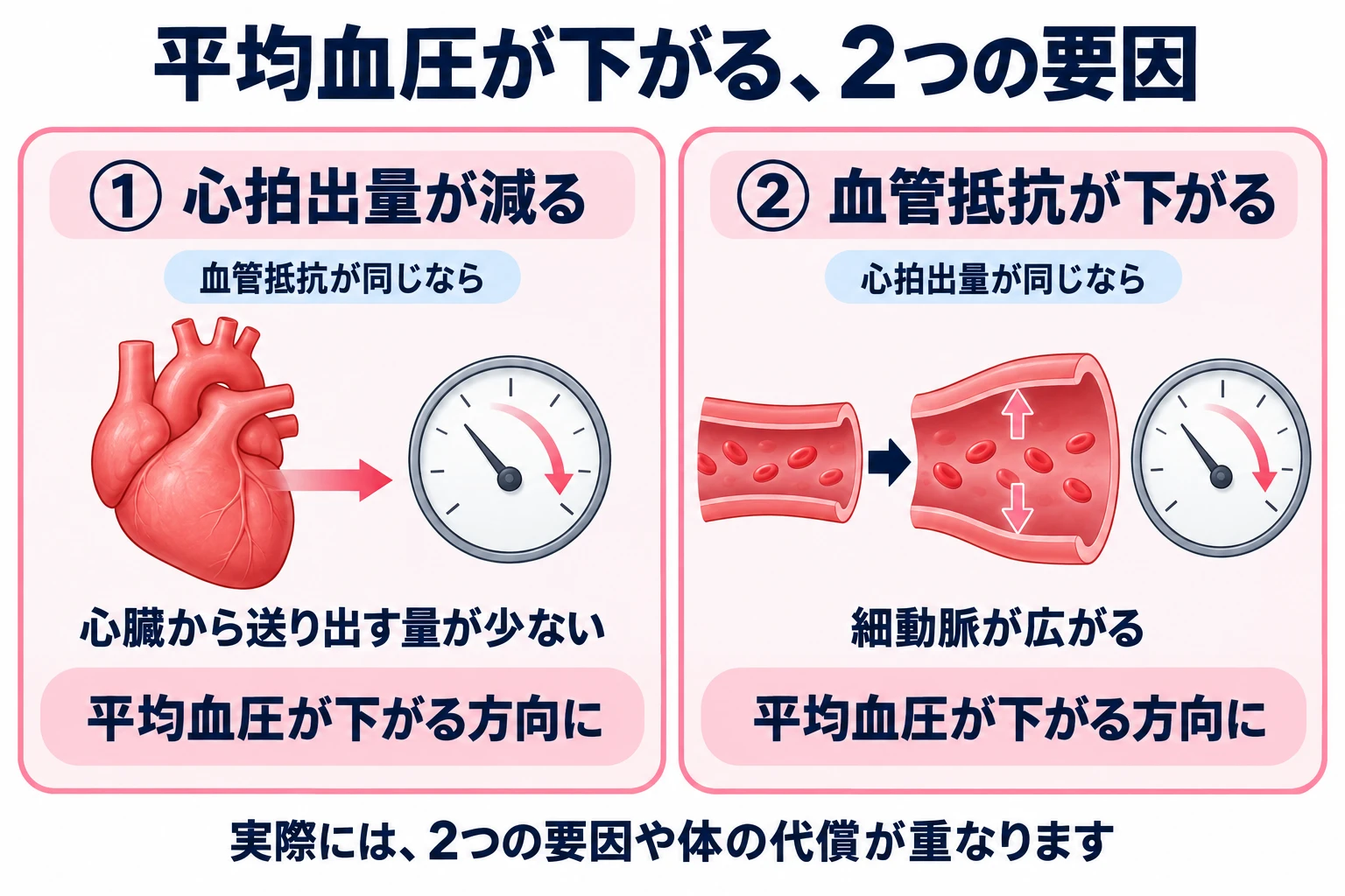 平均血圧が下がる2つの要因を示した図。左は「①心拍出量が減る」：血管の抵抗が同じなら、心臓から送り出す量が少ないと、平均血圧が下がる方向に動く（心臓と、針が下がる圧力計の絵）。右は「②血管抵抗が下がる」：心拍出量が同じなら、細動脈が広がると、平均血圧が下がる方向に動く（細い血管が広がる絵と圧力計）。下に「実際には、2つの要因や体の代償が重なります」。
