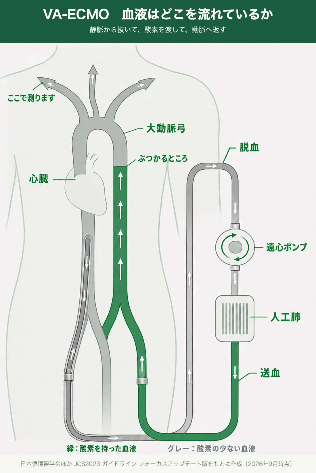 VA-ECMOで血液がどこを流れているかを示した図。体の中に大動脈と心臓、体の外に遠心ポンプと人工肺を描いている。大腿静脈から脱血した酸素の少ない血液(グレー)が遠心ポンプで回され、人工肺で酸素を渡されて緑になり、大腿動脈へ送血されて下行大動脈を足のほうから上へのぼる。いっぽう心臓が押し出した酸素の少ない血液は上行大動脈から大動脈弓の3本の枝へ流れる。両者がぶつかるところが下行大動脈の途中にできる。大動脈弓から出る枝のうち右上肢へ向かう枝に「ここで測ります」と示されている。