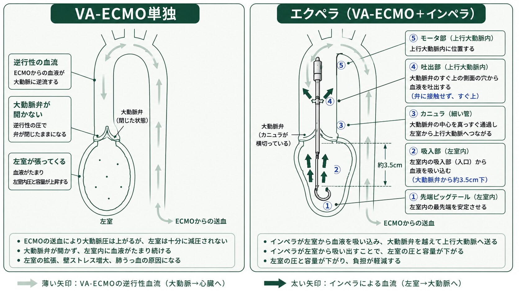 VA-ECMO単独とエクペラの比較図。VA-ECMO単独では逆行性の血流が抵抗となり大動脈弁が開かず左室が張る。エクペラではインペラのカニュラが大動脈弁の中心を真っすぐ通り、左室内の吸入部から吸い込んだ血液を弁のすぐ上の吐出部から上行大動脈へ送るため、左室の圧と容量が下がる。下に、薄い矢印はVA-ECMOの逆行性の血流、太い矢印はインペラによる血流を示す説明。