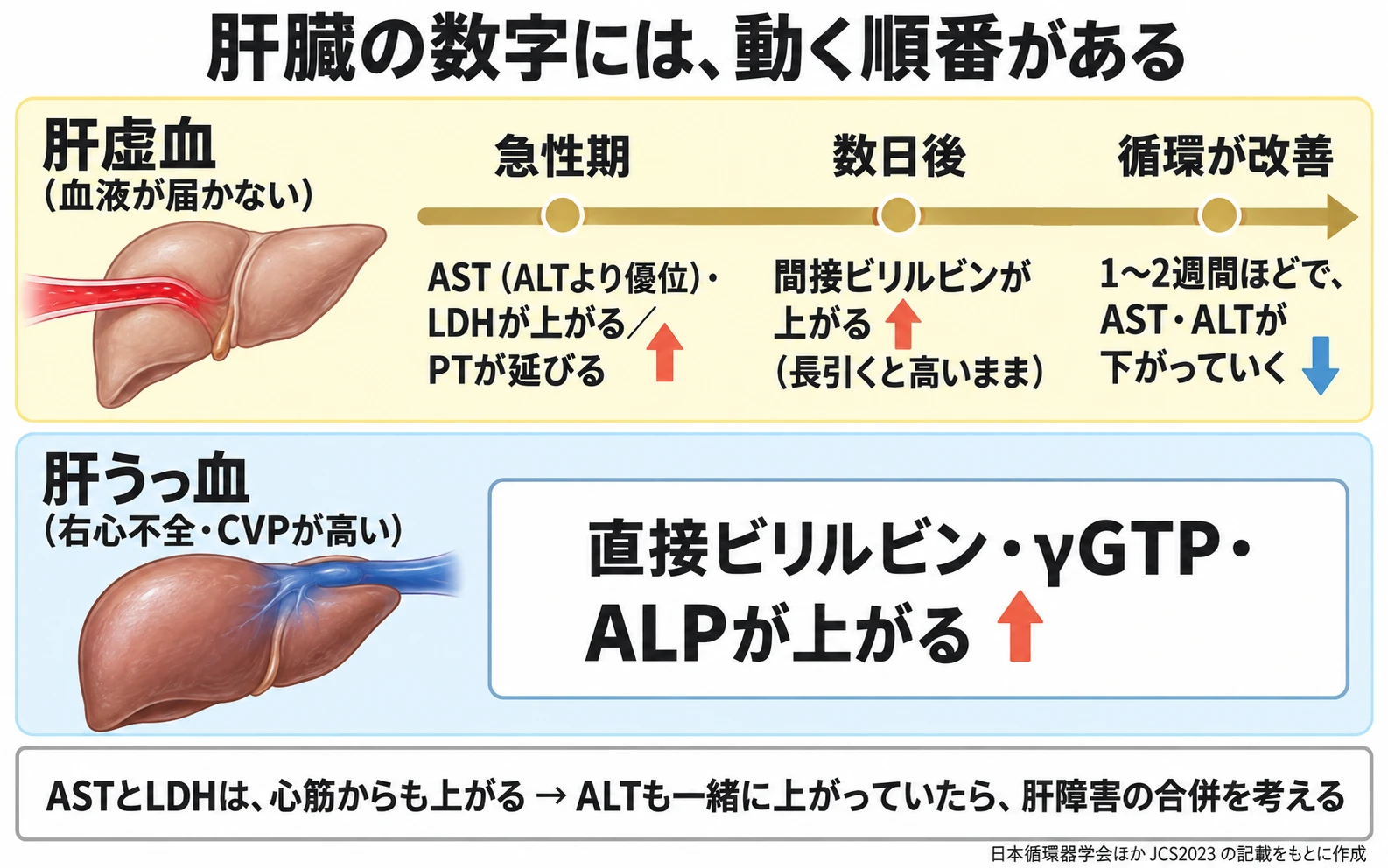 肝臓の採血データが動く順番を示した図。上の段は肝虚血(血液が届かない)で、時間の流れにそって、急性期にAST(ALTより優位)・LDHが上がりPTが延びる、数日後に間接ビリルビンが上がる(長引くと高いまま)、循環が改善すると1〜2週間ほどでAST・ALTが下がっていく。下の段は肝うっ血(右心不全・CVPが高い)で、直接ビリルビン・γGTP・ALPが上がる。下の枠に、ASTとLDHは心筋からも上がるので、ALTも一緒に上がっていたら肝障害の合併を考える。