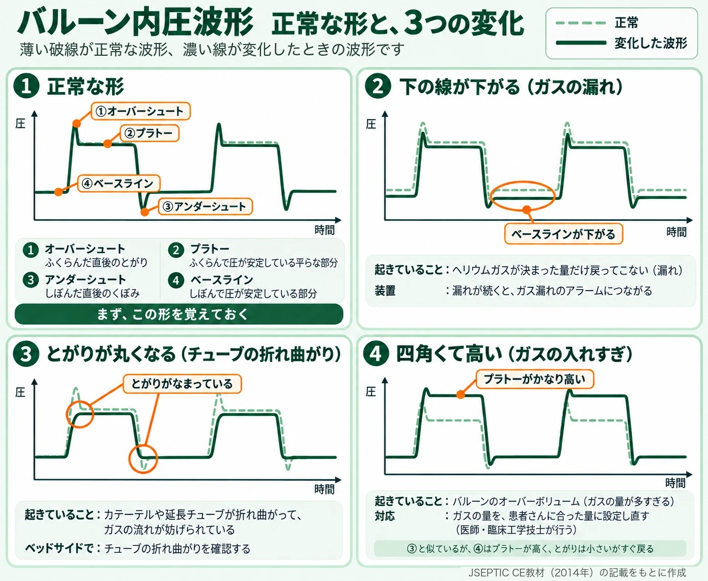 IABPのバルーン内圧波形を4つ並べた図。①正常な形：オーバーシュート、プラトー、アンダーシュート、ベースラインの4つの部分。②ガスの漏れ：ベースラインが正常より下がる。③チューブの折れ曲がり：オーバーシュートとアンダーシュートのとがりがなまって丸くなる。④ガスの入れすぎ（オーバーボリューム）：全体が四角い形になり、プラトーがかなり高い。薄い破線が正常な波形。