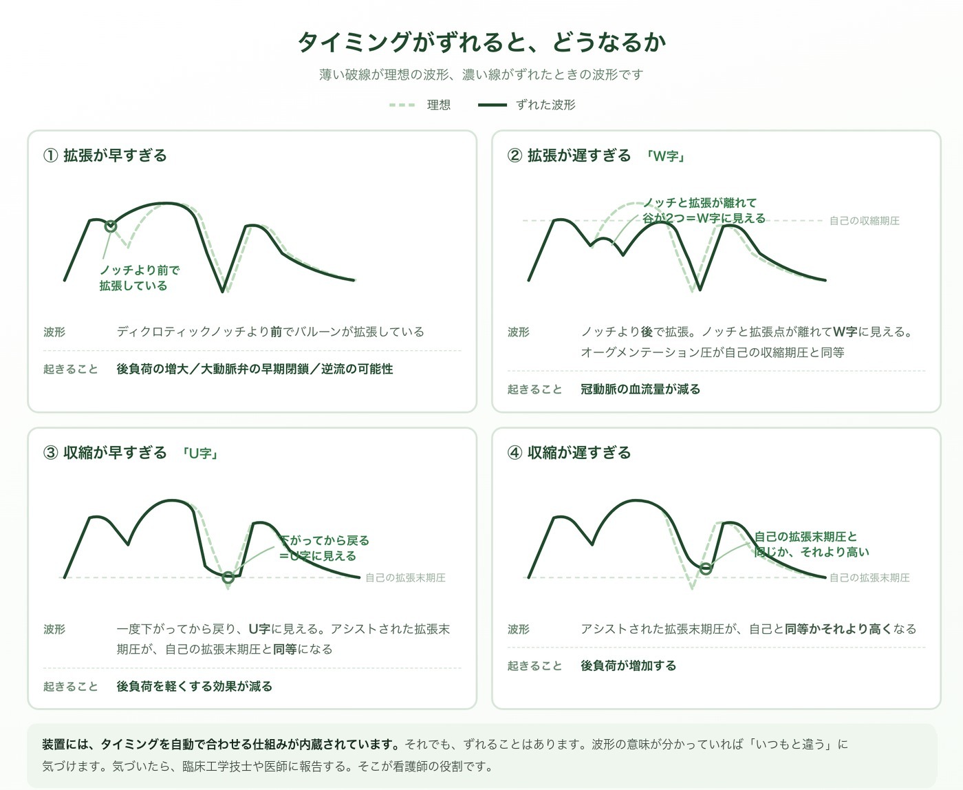 IABPのタイミングがずれたときの波形を4つ並べた図。①拡張が早すぎるとノッチより前で立ち上がる。②拡張が遅すぎると谷が2つできてW字に見え、オーグメンテーション圧は自己の収縮期圧と同等になる。③収縮が早すぎると一度下がってから戻りU字に見える。④収縮が遅すぎると拡張末期圧が自己と同等かそれより高くなる。薄い破線が理想の波形。