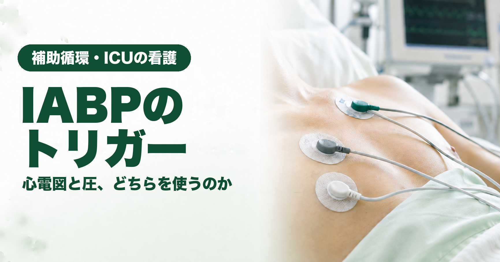 記事「IABPのトリガー｜心電図と圧、どちらを使うのか」のアイキャッチ画像。胸に貼られた心電図の電極とリード線が写り、背景にICUのモニターが見える。左側に「補助循環・ICUの看護」「IABPのトリガー」「心電図と圧、どちらを使うのか」の文字。