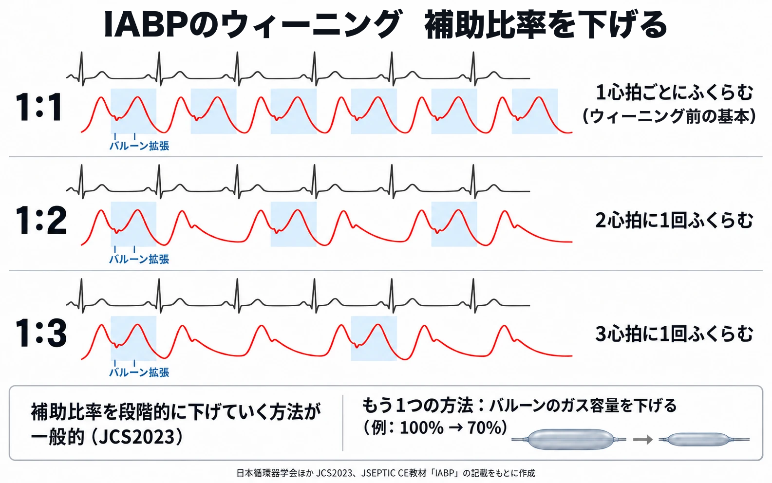IABPのウィーニングで補助比率を下げる図。上から1:1、1:2、1:3の3段で、それぞれ同じ心電図6拍と動脈圧波形を並べている。バルーンがふくらむ心拍では、ディクロティックノッチのあとに拡張期の2つめの山が出て、淡い青の帯で「バルーン拡張」と示している。1:1は1心拍ごとにふくらむ(ウィーニング前の基本)、1:2は2心拍に1回、1:3は3心拍に1回ふくらみ、ふくらまない心拍は2つめの山のないふつうの波形。下に、補助比率を段階的に下げていく方法が一般的(JCS2023)、もう1つの方法としてバルーンのガス容量を下げる(例:100%から70%)。