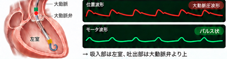 正しい位置の波形。位置波形は大動脈圧波形、モータ波形はパルス状。吸入部は左室、吐出部と光学センサは大動脈弁より上にある。